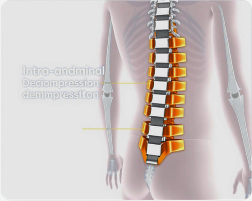 AOFIT Spinal & Pelvic Support Manufacturer - LSO Brace