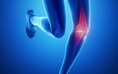 How Knee Braces Help ACL Recovery