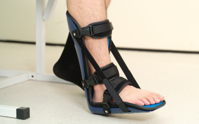 Best Ankle Brace For Plantar Fasciitis: Tested And Reviewed