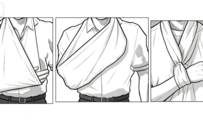 Elevation Sling Vs Arm Sling Vs Collar and Cuff Sling: Which Is Better For You