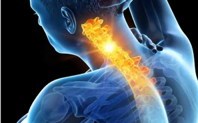 Does a Cervical Collar Help Neck Pain?