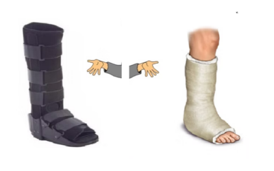 Walker Boots Vs Plaster Casts: Which Is Better For Broken Ankles