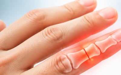 How Long To Wear a Finger Splint For Fracture